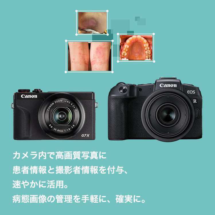 カメラ内で高画質写真に患者情報と撮影者情報を付与、速やかに活用。病態画像の管理を手軽に、確実に。